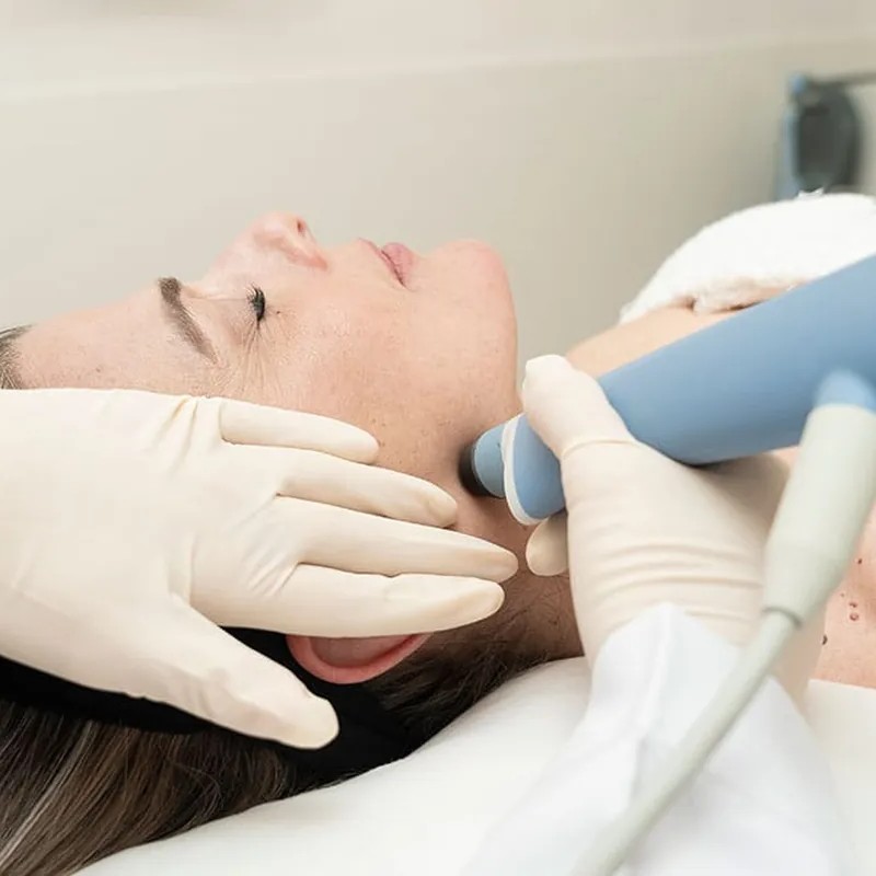 Sesión de Exion facial en Centro Médico List