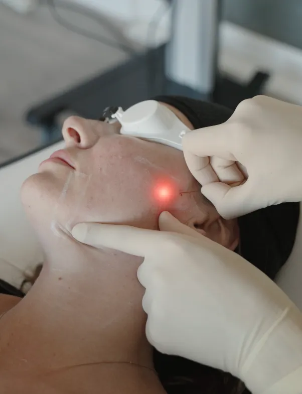 Fibra óptica del láser Endolift, tecnología subdérmica