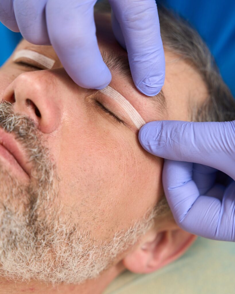 Valoración periocular antes de una blefaroplastia